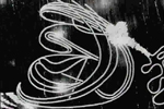 Infection Image